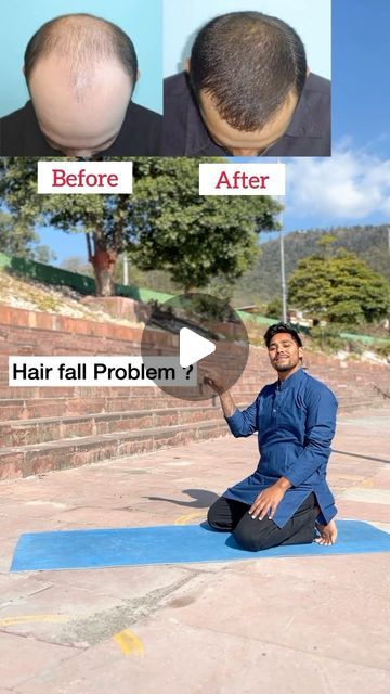 Yoga For Hair Fall Control, Hair Fall Remedy Home, Hair Fall Control Tips, Hair Fall Problem, Hair Fall Remedy, Hair Solution, Hair Fall Solution, Improve Nutrition, Reduce Hair Fall