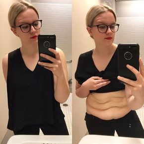 17 Women Share Pics of Loose Skin After Weight Loss to Prove How Common and Normal It Is | SELF Natural Skin Tightening, Skin Tightening Face, Tighten Loose Skin, Excess Skin, Saggy Skin, Loose Skin, Body Positive, Daily Habits, Better Skin