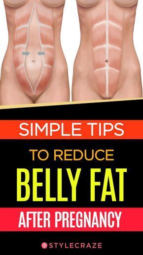 10 Simple Tips To Reduce Belly Fat After Pregnancy #women #pregnancy belly fat Pregnancy Women, Exercise Ideas, Mommy Dearest, Belly Fat Diet, Diastasis Recti, Health Nut, Post Pregnancy, Stomach Fat, Pregnant Belly