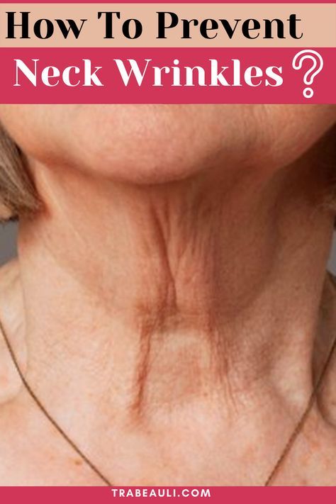 Neck wrinkles are a problem that happens to everyone at a certain age. Let's know the best ways to prevent them. Check out the blog- #neckwrinkles #homeremediesforwrinkles #wrinkles #skincare #skinproblems #remedy #preventneckwrinkles #getridofneckwrinkles Home Remedies For Wrinkles, Wrinkle Remedies, Neck Wrinkles, Brown Spots Removal, Skin Care Wrinkles, Skin Specialist, Deep Wrinkles, Loose Skin, Youthful Skin