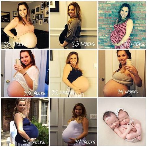 What Having 4 Kids (Including Twins) Has Done to My Body and My Confidence Bump Progression, Twin Belly, Twin Pregnancy Belly, Baby Bump Progression, Getting Pregnant With Twins, Madrid Logo, Postpartum Care Kit, Pregnant With Twins, Belly Photos