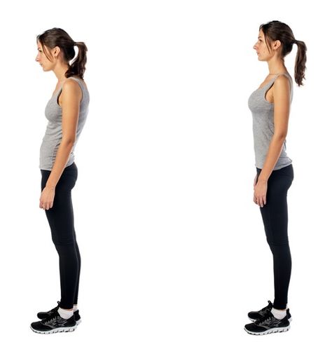 Posture Pictures Forward Head Posture Exercises, Posture Fix, Fix Your Posture, Forward Head Posture, Posture Exercises, Perfect Posture, Bad Posture, Better Posture, Poor Posture