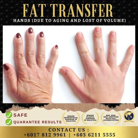 Fat Grafting, Cosmetic Injectables, Fat Transfer, Mommy Makeover, Aging Beautifully, Body Treatments, New Chapter, The Body, Beauty Health