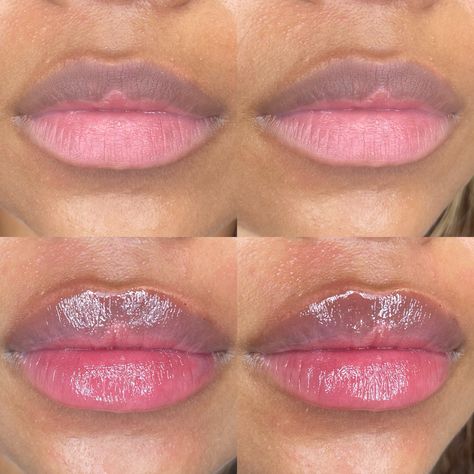 Lip filler before and afters by UPKEEP Med Spa. Find more juicy lip inspo and beauty aesthetics on our page or Instagram. Getting Lip Fillers, Lip Filler Before And After Black Women, Lip Filler Black Women, Lip Fillers Before And After, Lip Fillers Before And After 1ml, Lips Goals, Lip Filler Before And After, Lip Filler Inspiration, Lip Reference