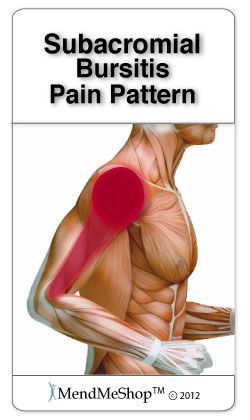 Subacromial Bursitis, Shoulder Bursitis, Deltoid Muscle, Bursitis Shoulder, Rotator Cuff Exercises, Shoulder Pain Exercises, Shoulder Rehab, Bursitis Hip, Shoulder Impingement