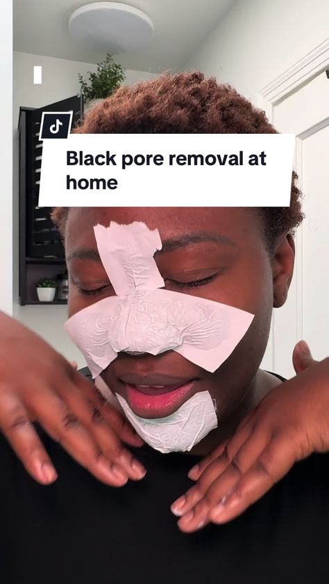 Blackhead Be Gone: Your Comprehensive Guide #Blackheads #skincare #blackheadremoval #cleanser #facecleanser #beautyhacks How To Remove Blackheads, Blackhead Remedies, To Remove Blackheads, Prevent Pimples, Remove Blackheads, Clear Complexion, Cold Sore, Skin Secrets, Blackhead Remover