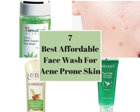 7 Best Affordable Face Wash For Acne Prone Skin Best Acne Cleanser, Face Wash For Acne, Dry Acne Prone Skin, Oil Control Face Wash, Heavy Blouse, Acne Moisturizer, Gentle Facial Cleanser, Skin Tea, Acne Removal