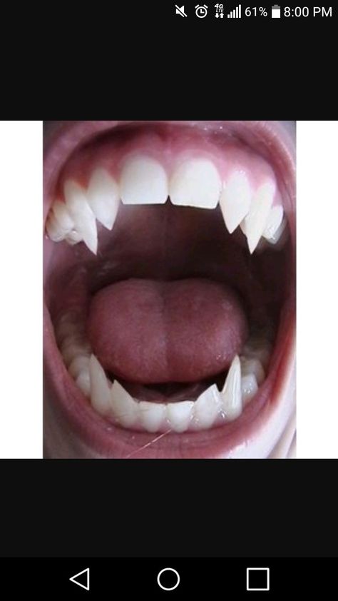 Vampire Teeth, Vampire Girls, Sharp Teeth, Team 7, Throne Of Glass, Urban Fantasy, Body Mods, Vampire Diaries, Character Inspiration