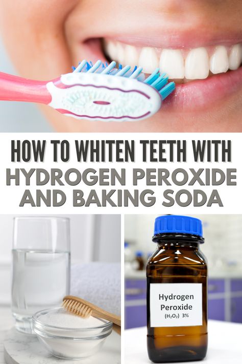 Peroxide And Baking Soda, Hydrogen Peroxide Teeth, Baking Soda Hydrogen Peroxide, Baking Soda Teeth, Natural Teeth Whitening Diy, Teeth Whiting At Home, Peroxide Teeth Whitening, Baking Soda Teeth Whitening, Teeth Whitening Homemade