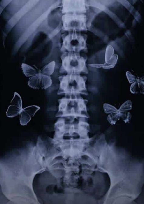 X Ray Butterfly, Butterflies In Stomach Aesthetic, R And B Playlist Cover, R And B Aesthetic, R&b Playlist Covers, Butterflies In Stomach, Y2k Pictures, Butterflies Poster, About Butterflies