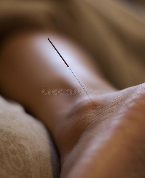 Acupuncture Needle. Acupuncture is the procedure of inserting and manipulating f , #Sponsored, #inserting, #manipulating, #procedure, #Acupuncture, #Needle #ad Acupuncture Needle, Acupuncture Needles, Acupuncture, Graphics Design, Design Branding, Book Covers, Ideas Para, Portland, Oregon