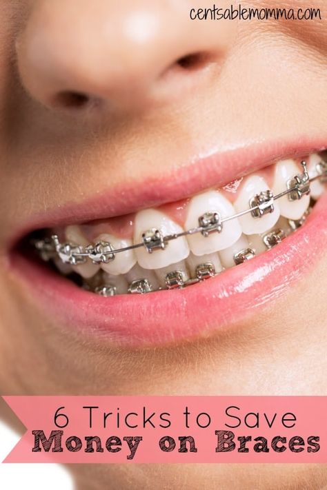 Braces can be super expensive, but there are ways to save money and make the cost work for your family. Check out these 6 tricks to save money on braces for some tips. #savemoney #budget #frugal #finances Braces Care, Braces And Glasses, Fixed Braces, Braces Cost, Frugal Meal Planning, Adult Braces, Getting Braces, Dental Supplies, Hacks Diy