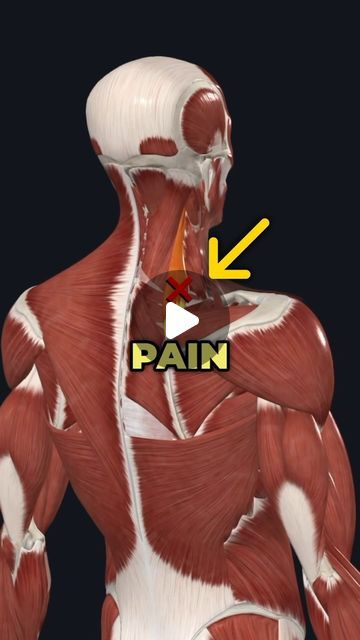 Dr. Adam McCluskey PT, DPT on Instagram: "❌This small muscle could be causing your neck and shoulder pain! (Full Program @theptinitiative Bio Link)
—
There is a small muscle that connects the shoulder blade to the neck, and can be really problematic if it gets overactive and tight.
—
It’s called the Levator Scapulae and it is a common source of neck pain and shoulder blade movement problems.
—
This muscle helps you elevate your shoulder blade, and bend your neck to the side, but can limit your ability to lift your arm overhead optimally if it’s restricted.
—
To begin fixing this issue I recommend doing this active Levator Scapulae release technique with a lacrosse ball to decrease the tonicity and tightness of this muscle.
—
Then we need to actively reinforce this new position by training Scapula Pain, Neck Muscle Pain, Shoulder Blade Muscles, Neck Muscle Anatomy, Neck Spasms, Levator Scapulae, Neck And Shoulder Stretches, Muscles Of The Neck, Neck Muscles