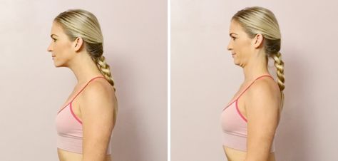 Tech Neck Stretches, Bell’s Palsy, Yoga Neck, Neck Posture, Better Posture Exercises, Chin Tuck, Repetitive Strain Injury, Tech Neck, Sore Neck