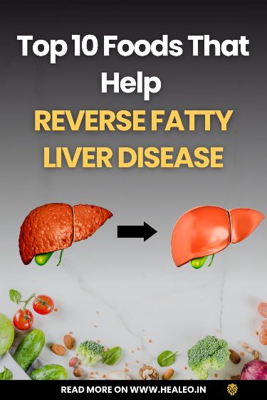 Revitalize Your Liver: 10 Essential Foods to Combat Fatty Liver Disease Unveil the natural power of these foods to rejuvenate your liver health and reverse fatty liver disease. With the right choices, your journey towards a healthier you begins here. #Health #Essential #Tips #Maintaining #Liver #for #HealthTips #a #Diet #Healthy #NutritionTips #Liver #Home Food Good For Liver, Liver Diet Plan, Foods For Liver Health, Liver Healthy Foods, Liver Diet Recipes, Healthy Liver Diet, Heal Liver, Liver Recipes, Liver Diet