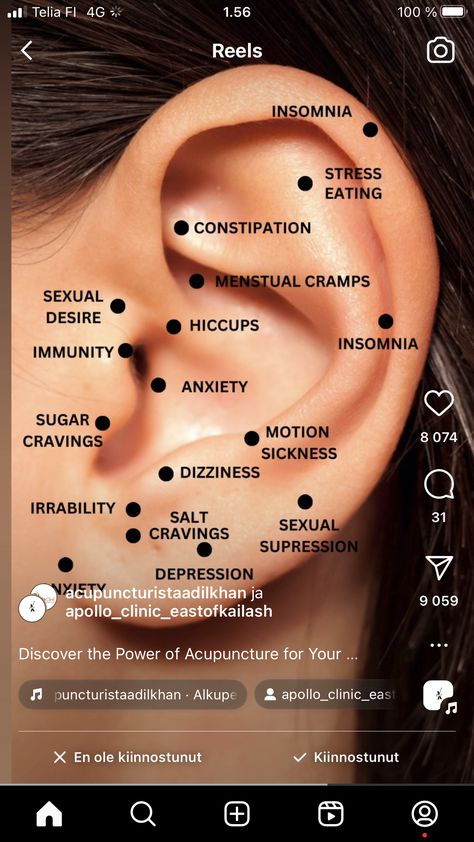 Internal Health, Healing Reflexology, Ear Reflexology, Ear Seeds, Acupressure Therapy, Point Acupuncture, Reflexology Chart, Acupressure Massage, Naturopathic Medicine