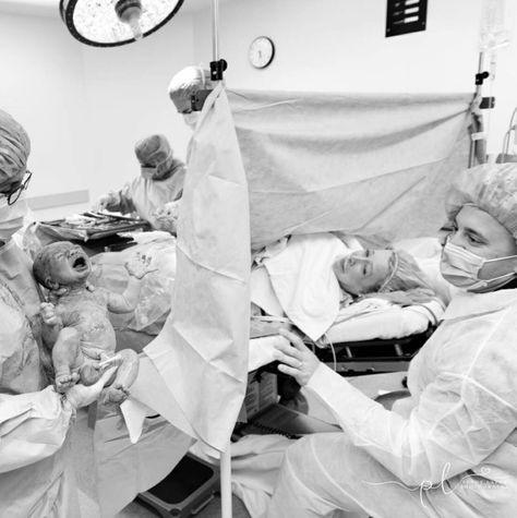 26 Stunning Photos That Capture The Sheer Strength Of C-Section Moms | HuffPost Life Child Birth Photography, Birth Photography Hospital, Baby Hospital Photos, Labor Photos, Newborn Hospital Pictures, Baby Hospital Pictures, Birth Pictures, Delivery Pictures, Hospital Pictures