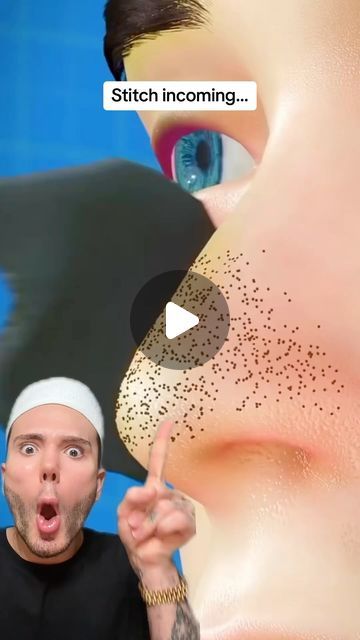 Matt Randon 🧩 on Instagram: "HOW TO GET RID OF BLACKHEADS!😱 (follow for more!💗)

@coxir_official partner. Porestrips DO NOT work. Double cleansing is way more effective at getting rid of those blackheads and using a pore mask regularly will help them not come back! 

#blackhead #blackheads #blackheadremover #skincarecommunity #skincarejunkie #skincareaddict #skincarelover #skincareroutines #skincarereview" How To Get Rid Of Blackheads Around Lips, How To Clear Blackheads On Face, How To Get Rid Of Black Heads, How To Get Rid Of Blackheads, Diy Blackheads Removal, Matt Randon, Black Head Removal Video Nose, Best Blackhead Remover, Homemade Pore Strips