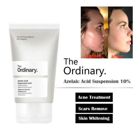 The Ordinary Azelaic Acid, Haut Routine, Clear Healthy Skin, Natural Face Skin Care, Skin Care Tutorial, Basic Skin Care Routine, Clear Skin Tips, Azelaic Acid, Healthy Skin Tips