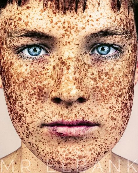 The diversity between people's outward appearances is one of the most fascinating aspects of humanity. Ongoing photography project #Freckles focuses on jus Freckle Photography, Girl With Freckles, People With Red Hair, People With Freckles, Women With Freckles, Mascara Hacks, Beautiful Freckles, Fair Complexion, Freckles Girl