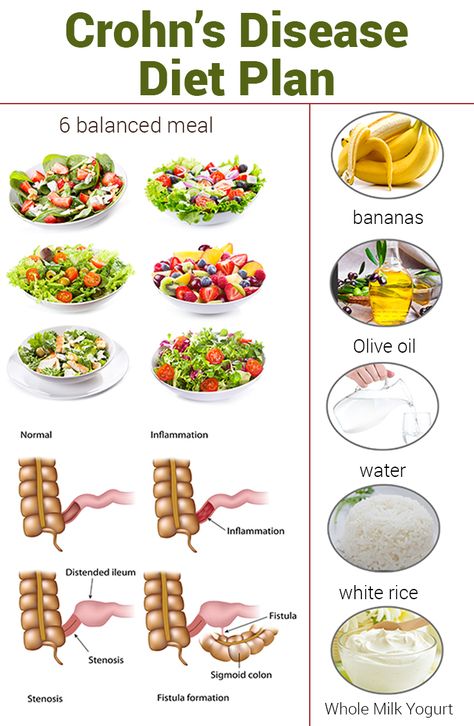 Are you looking for a diet plan to get rid of crohn's disease? Then here's an effective crohns diet plan to follow. Learn how you can include in your routine. Crohns Diet, Crohns Recipes, Reduction Diet, Best Diet Foods, Baking Powder Uses, Best Diet Plan, Low Fat Diets, Healthy Diet Plans, A Diet Plan