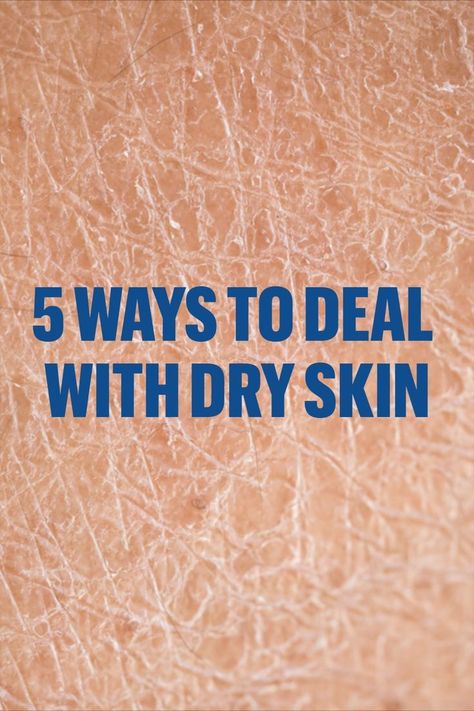 6 Best Natural Ways to Lighten Dark Spots Winter Dry Skin Care, How To Remove Dryness From Face, How To Stop Dry Skin On Face, What To Do For Dry Skin, How To Remove Dry Skin From Face, Dry Skin Remedies For Body Winter, Best Soap For Dry Skin, How To Get Rid Of Dry Skin, Dryness On Face