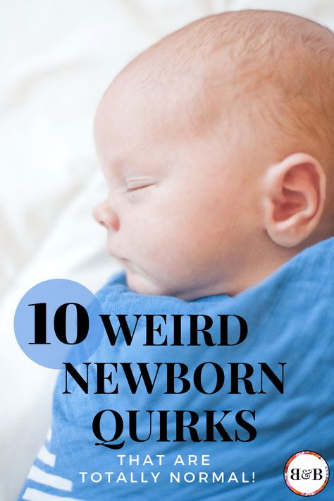 Ever been grossed out by baby crusty eye? Or wondered if it’s normal for your newborn’s skin to peel? That’s understandable since there are a lot of weird things that happen with these cute little babies! Watch the video below for 10 really strange quirks you might see. Newborn Skin Peeling, Crusty Eyes, Social Media Website Design, Media Website Design, Allergy Eyes, Baby Acne, One Month Baby, Peeling Skin, Newborn Babies