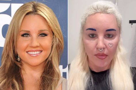 Amanda Bynes Feels Confident After Bleph Surgery Amanda Bynes Now, Thousand Oaks California, What A Girl Wants, Amanda Bynes, American Pie, Thousand Oaks, Sketch Comedy, Acting Career, Early 2000s