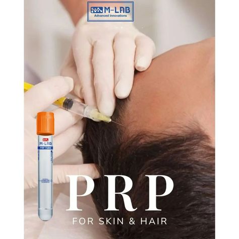 Do you know about M-LAB PRP Tubes and kit ? Consider a healing remedy sourced from the innate curative capabilities of your body. M-LAB PRP injection, with its innovative applications in specialties like PRP Ophthalmology, dermatology,and hair rejuvenation with M-LAB PRP Tubes, is attracting attention in the medical field. This article explores M-LAB PRP Tubes And kit platelet-rich plasma, revealing its amazing benefits and various applications. For those interested in the latest medical i... Prp Injection, Wedding Skin, Prp Therapy, Prp Hair, Happy Independence Day India, Platelet Rich Plasma, For Educational Purposes Only, Cream Face, Skin Aging