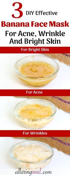 Face Mask For Acne, Banana Mask, Skin Tightening Mask, Mask For Acne, Banana Face Mask, Skincare Solutions, Face Cream For Wrinkles, Banana Benefits, Dark Armpits