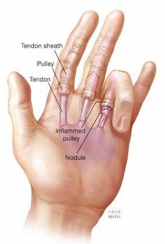 Trigger Finger Exercises, Autogenic Training, Finger Exercises, Trigger Finger, Muscle Anatomy, Hand Massage, Medical Anatomy, Hand Therapy, Medical Knowledge