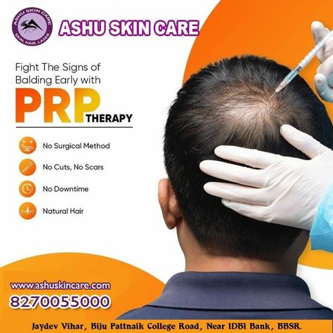 Prp For Hair Growth, Hair Prp Before And After, Hair Transplant Creative Ads, Prp For Hair, Platelet Rich Plasma Therapy, Prp Therapy, Hair Implants, Dental Posts, Prp Hair