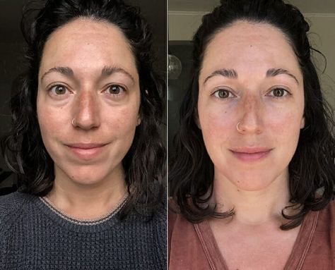 Gua Sha Over 50, Facial Gua Sha Before And After, Gua Sha For Wrinkles, Gua Sha Under Eye Bags, Under Eye Gua Sha, Gua Sha Under Eye, Gua Sha For Under Eye Bags, Gua Sha Wrinkles, 21 Day Gua Sha Challenge