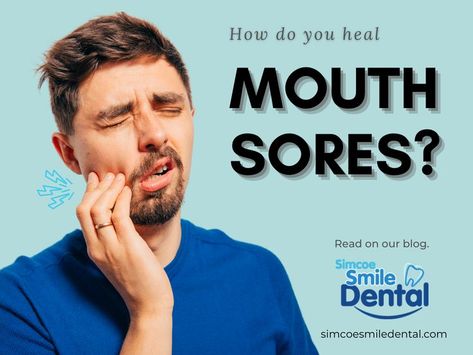 Mouth sores are one of the most common types of oral health issues. Although some may be mild, others may be a symptom of deeper problems. Read on to understand the most common mouth sores and how to treat them. Mouth Sore, Dental Services, Oral Health, Health Issues, Health