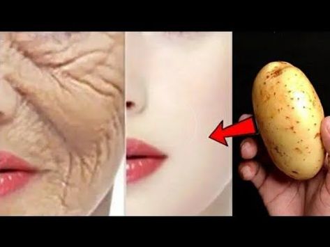 Aging Skin Remedies, Obličejové Masky, Wrinkles Remedies Face, Anti Aging Remedies, Wrinkle Remedies, Natural Beauty Remedies, Anti Aging Wrinkles, Skin Care Wrinkles, Face Wrinkles