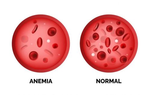 Causes of High and Low Hemoglobin Levels - Facty Health Medical Assistant Student, Hemoglobin Levels, Cells And Tissues, Penyakit Jantung, Vitamin Deficiency, Pulmonary Disease, Red Blood Cells, Blood Cells, Pediatrics