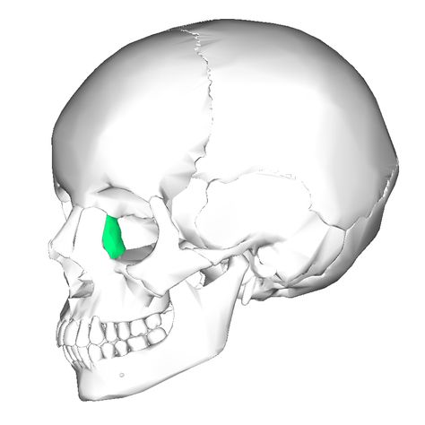 Lacrimal bones: 2 bones. Medial walls of orbit . Contain lacrimal fossa (deep groove) that houses for lacrimal sac (collect tears from the surface of eyes) Lacrimal Bone, Cheek Implants, Anatomy Flashcards, Anatomy Images, Body Bones, Facial Bones, Doll Therapy, Craniosacral Therapy, Skeletal System