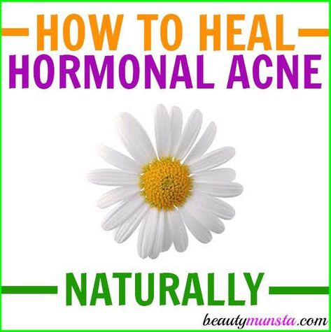 If you want to treat your hormonal acne naturally, follow this DIY hormonal acne protocol! It uses natural ingredients and simple holistic approaches to manage hormonal acne! Causes of Hormonal Acne What is hormonal acne? It’s simply acne caused by excess hormones in the body, especially the hormone testosterone. Now both men and women have … #AcneCauses Acne Men, Cystic Acne Treatment, Natural Acne Remedies, Natural Acne, Acne Causes, Hormonal Acne, Cystic Acne, Acne Free, Acne Remedies