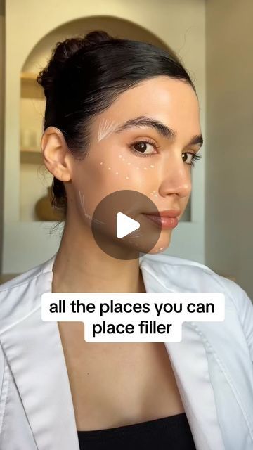 Miranda Wilson MSN-FNP on Instagram: "*** all the places I place dermal filler‼️‼️ . . . There are providers that do inject the nose however I do not put filler in the nose due to high risk of vascular occlusions! the same goes for the forehead.  . . . Comment below with your favorite spot for filler!  . . #filler #antiaging #dermalfiller" Pixie Tip Lift Nose Filler, Forehead Filler Before And After, Natural Fillers For Face, Nasal Labial Folds Filler, Nasiolabel Folds Filler, Cheek Filler Injection Sites, Midface Cheek Filler, Filler Injection Sites, Dermal Fillers Before And After