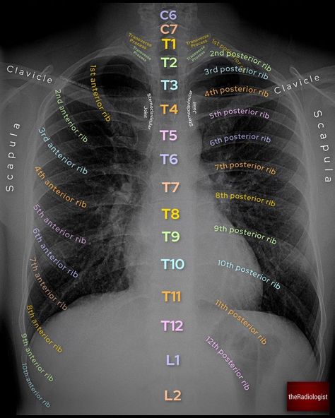 Radiology Technician Aesthetic, Radiology Student Aesthetic, Radiography Student, Radiology Schools, Medical Radiography, Medical Assistant Student, Radiology Student, Radiology Technician, Radiology Imaging