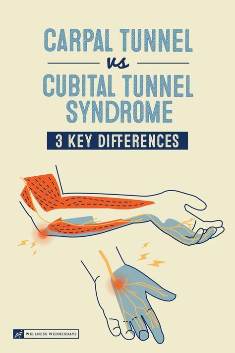 Hand Stretches Carpal Tunnel Exercise, Carpultunal Exercise, Stretches For Carpal Tunnel, How To Help Carpal Tunnel, Cubital Tunnel Syndrome Exercises, Carpal Tunnel Taping, Cubital Tunnel Syndrome Relief, Hand Exercises For Carpal Tunnel, Carpel Tunnel Stretch