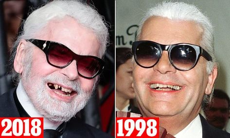 Teeth Braces, Missing Teeth, Vacation Video, Packing Tips For Vacation, Packing Tips, The Chic, Square Sunglasses Women, Daily Mail, Karl Lagerfeld