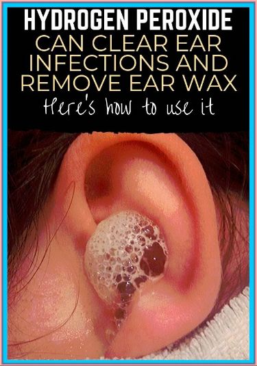 Hydrogen Peroxide Can Clear Ear In by kimberly Harris | This newsletter was created with Smore, an online tool for creating beautiful newsletters for educators, businesses and more Hydrogen Peroxide Ear, Ear Wax Buildup, Face Pores, Ear Infections, Ear Wax Removal, Wax Strips, Healthy Liver, Ear Cleaning, Makeup Looks For Brown Eyes