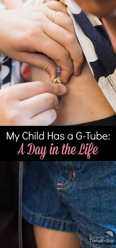 Feeding Tube Awareness, Child Life Specialist, Special Needs Mom, Pediatric Therapy, Feeding Tube, Sensory Processing Disorder, Special Needs Kids, Play Based Learning, Child Life