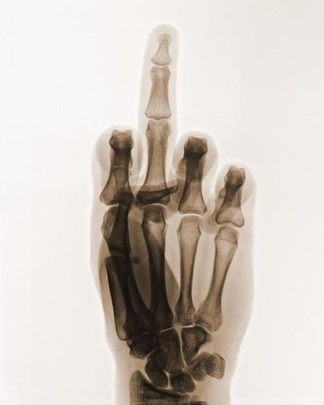 The Palm, Bones, Black And White, White, Black