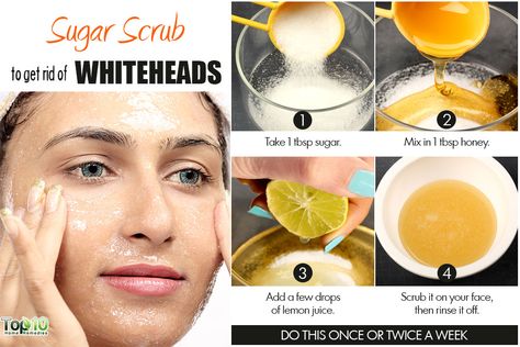 sugar scrub to remove whiteheads Remove Whiteheads, Whiteheads Remedy, Hair Removal Diy, Exfoliating Face Scrub, Face Scrub Homemade, Learn Yoga, Acne Remedies, Homemade Face Masks, Skin Pores