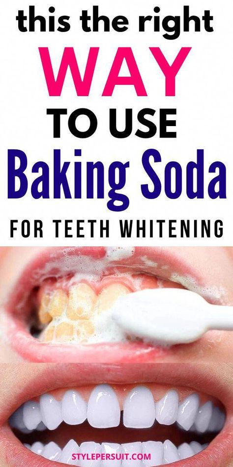 How To Use Baking Soda To Whiten Your Teeth: if you want to explore natural teeth whitening treatments, baking soda is a great option. Read on to know more about the benefits of using baking soda to get pearly white teeth. #teethwhitening #whiteteeth #remedies #homeremedies White Teeth Baking Soda, Baking Soda For Teeth, Natural Remedies For Cavities, Pearly White Teeth, Natural Teeth Whitening Diy, Diy Toothpaste, Baking Soda Teeth Whitening, Teeth Remedies, Teeth Whitening Homemade