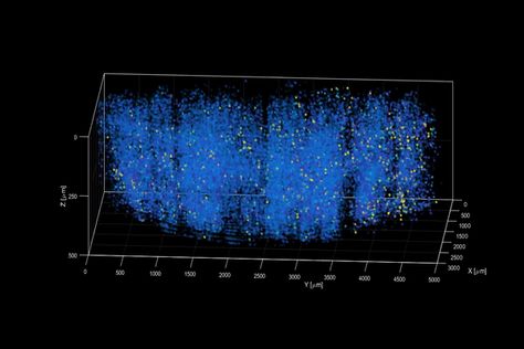 Neural Connections, Brain Activities, The Veil, Human Being, Neuroscience, A Mouse, Scientists, 1 Million, Science And Technology