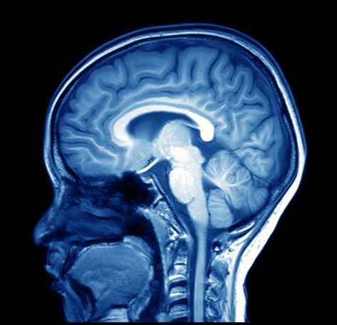 Mri Brain, Brain Images, Frontal Lobe, Brain Scan, Mri Scan, Ct Scan, Magnetic Resonance, Gray Matters, Human Brain