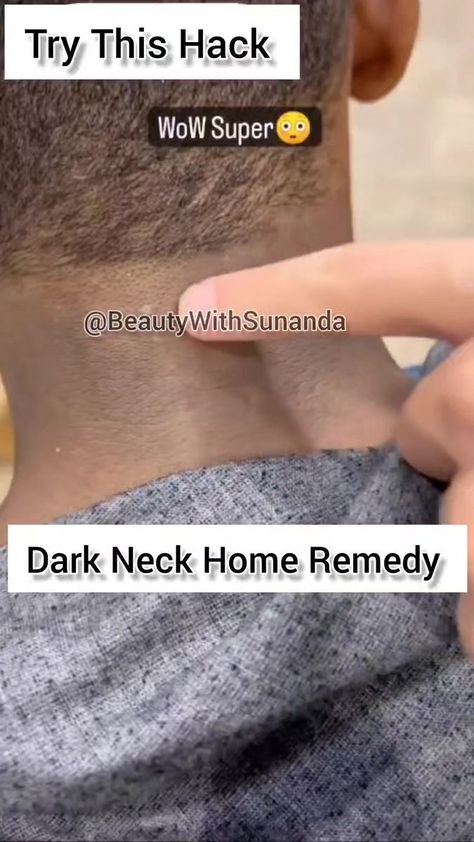 Permanently Remove Dead Skin Easily At Home/ Dark Neck Home Remedy#shorts#ytshorts#skincare | Beauty With Sunanda | Jubin Nautiyal · Meethi Meethi Detanning Skin, Dark Neck Remedies, Earache Remedies, Sunburn Peeling, Dark Neck, Natural Face Care, Dead Skin Removal, Home Dark, Jubin Nautiyal